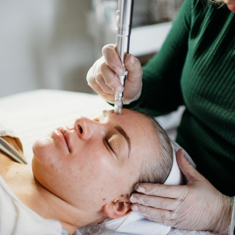 Microneedling