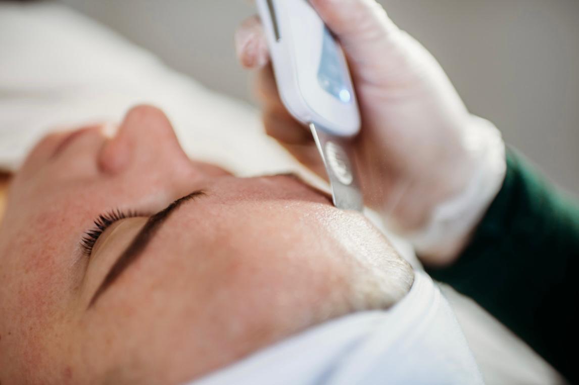 Dermaplaning