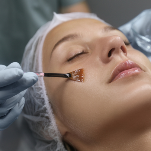 Chocolate Power Skin Peel